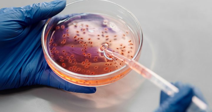 Zoonotic Catastrophe